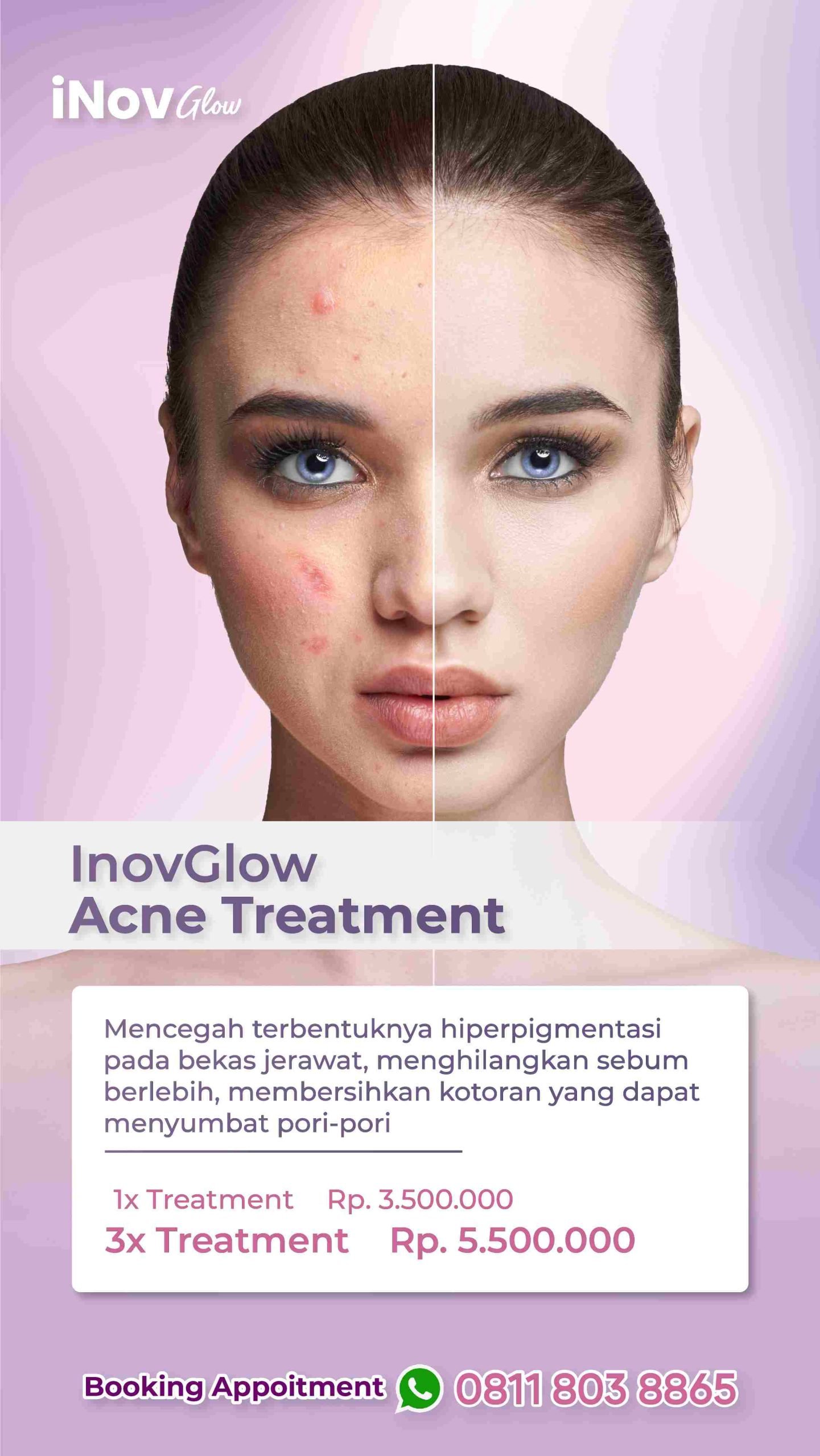 18 JULY 2023-04-fotor-202307191108