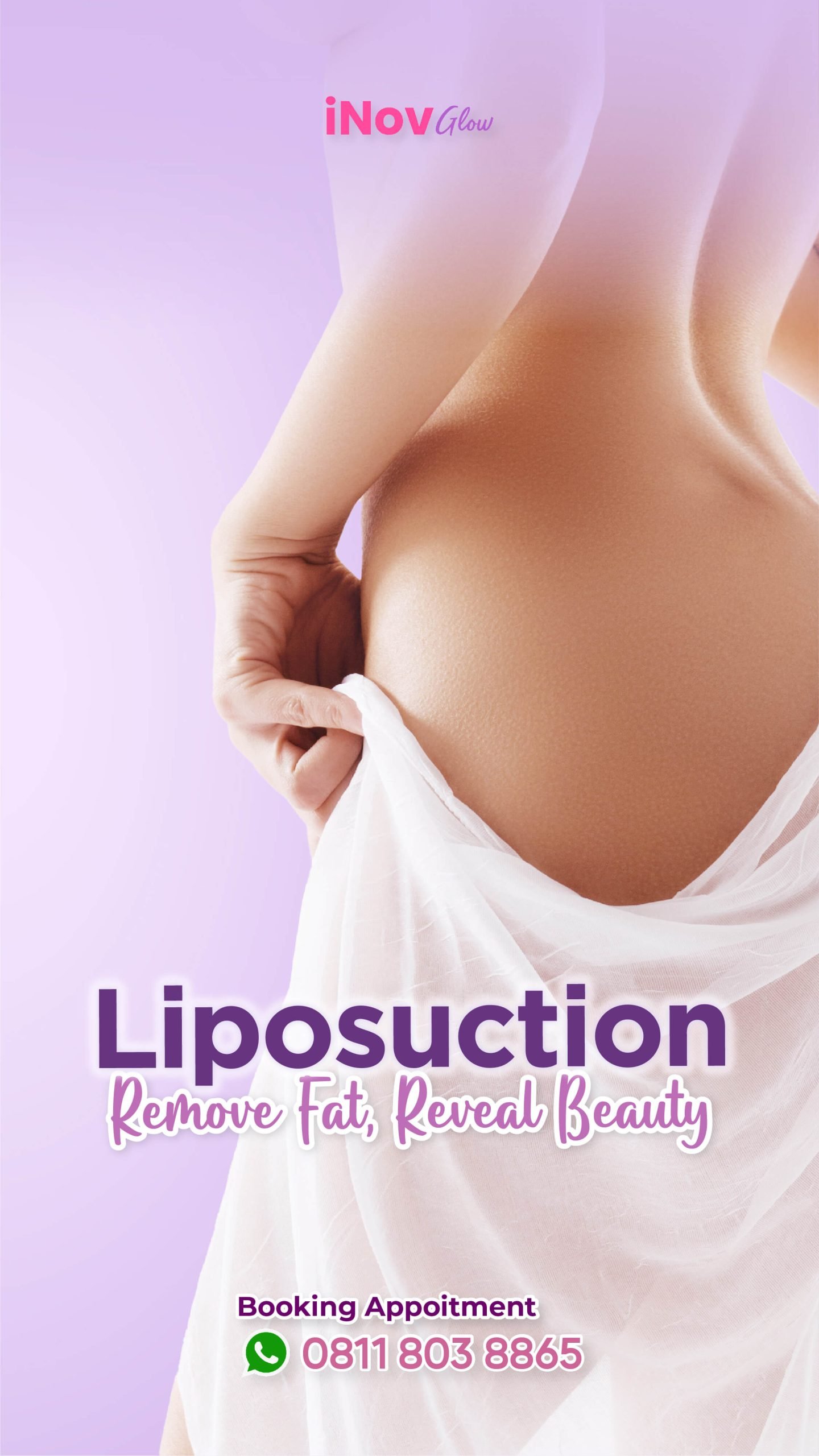 Operasi sedot lemak, atau liposuction Operasi sedot lemak, atau liposuction