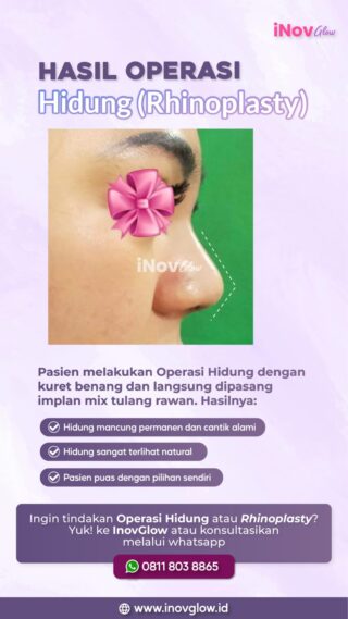 Operasi Hidung Mancung: Layanan Unggulan dari Inov Glow