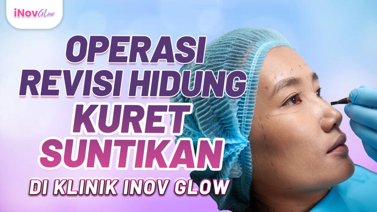 OP-Revisi-Hidung-Kuret-Suntikan-di-Klinik-Inov-Glow-Req-Andy-5-1200x675.jpg