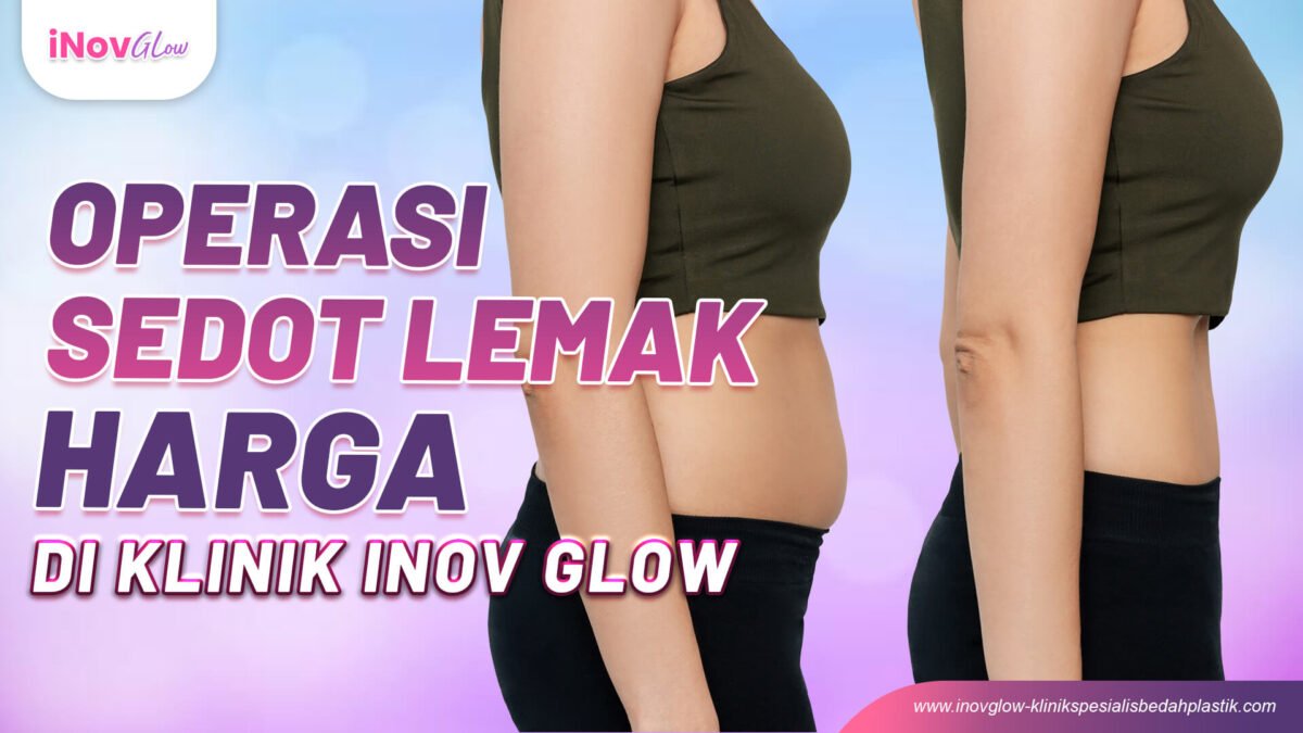 Operasi-Sedot-Lemak-Perut-di-Klinik-Inov-Glow-1200x675.jpg